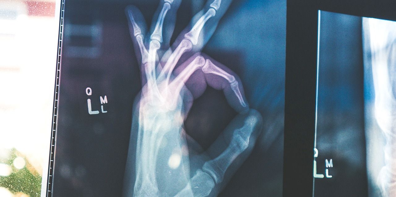radiografía de mano radiografía de mano